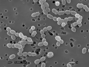 Dextran 5, MW 4-5k CAS 9004-54-0