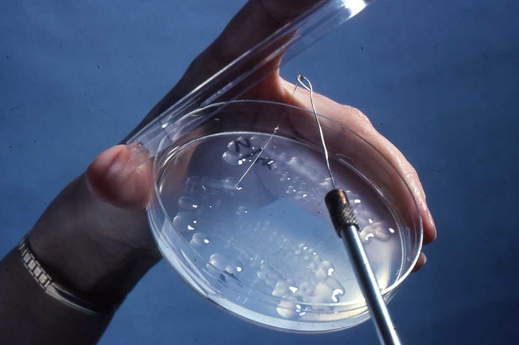 beta glucan from Saccharomyces cerevisiae